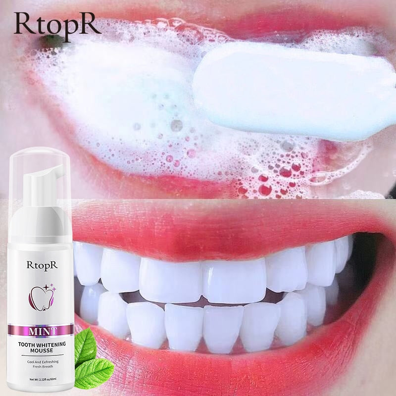 Teeth Whitening Mousse – Stain Removal, Gum Repair & Fresh Breath at Home