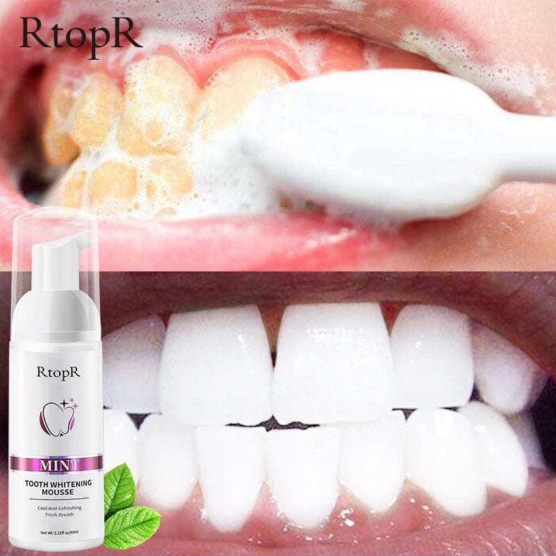 Teeth Whitening Mousse – Stain Removal, Gum Repair & Fresh Breath at Home