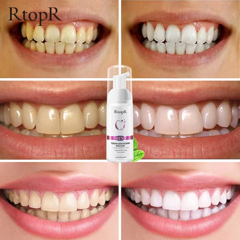 Teeth Whitening Mousse – Stain Removal, Gum Repair & Fresh Breath at Home
