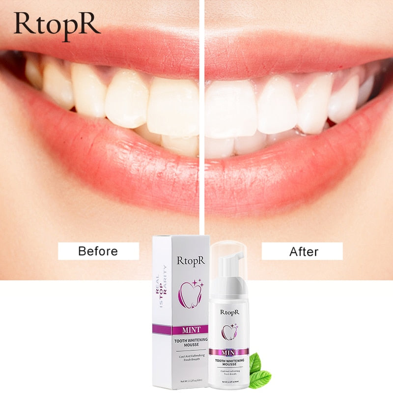 Teeth Whitening Mousse – Stain Removal, Gum Repair & Fresh Breath at Home