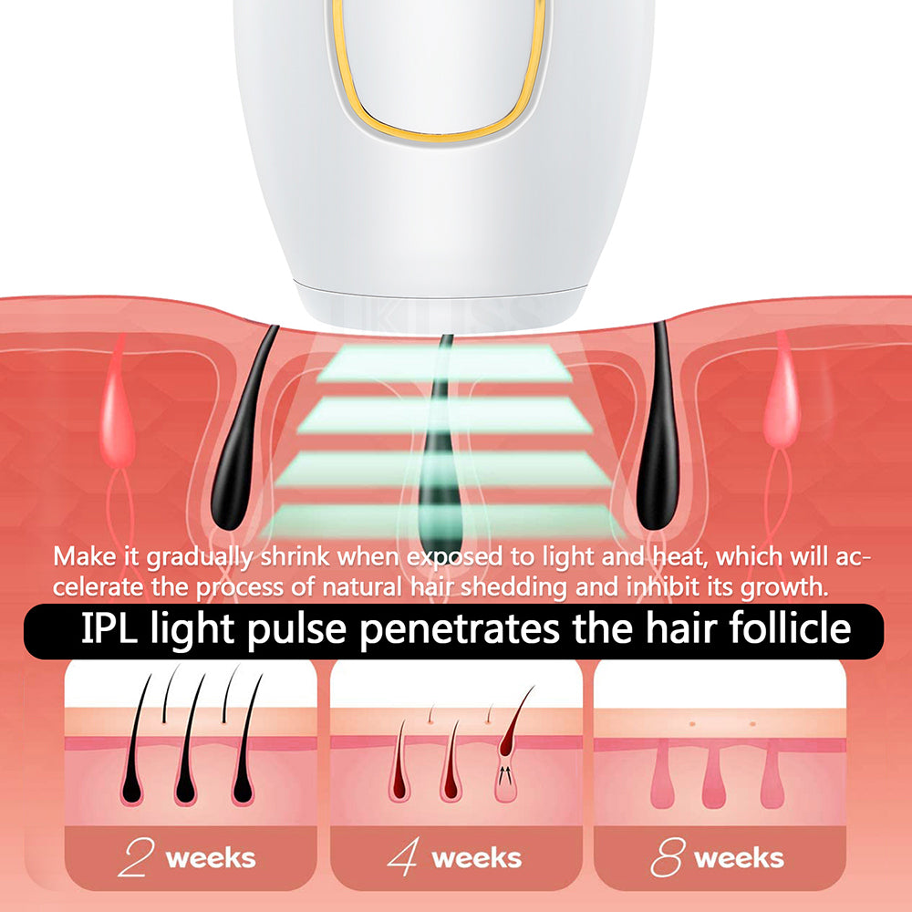 IPL Hair Removal Set – 500,000 Flashes, Adjustable Wavelength for Full Body Use